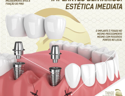 Implante dentário com estética imediata – É possível? Descubra!